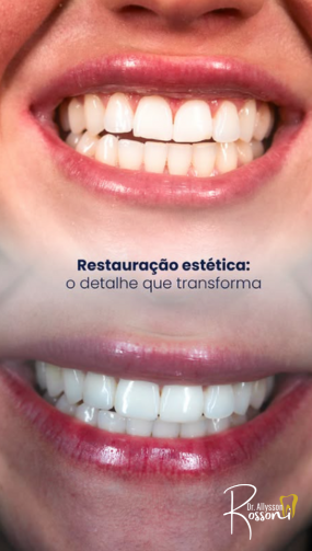 Resultado real de paciente — antes e depois