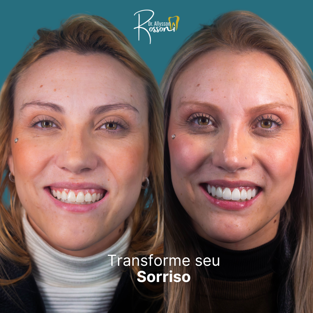 DENTISTA EM CAMPO LARGO (5)