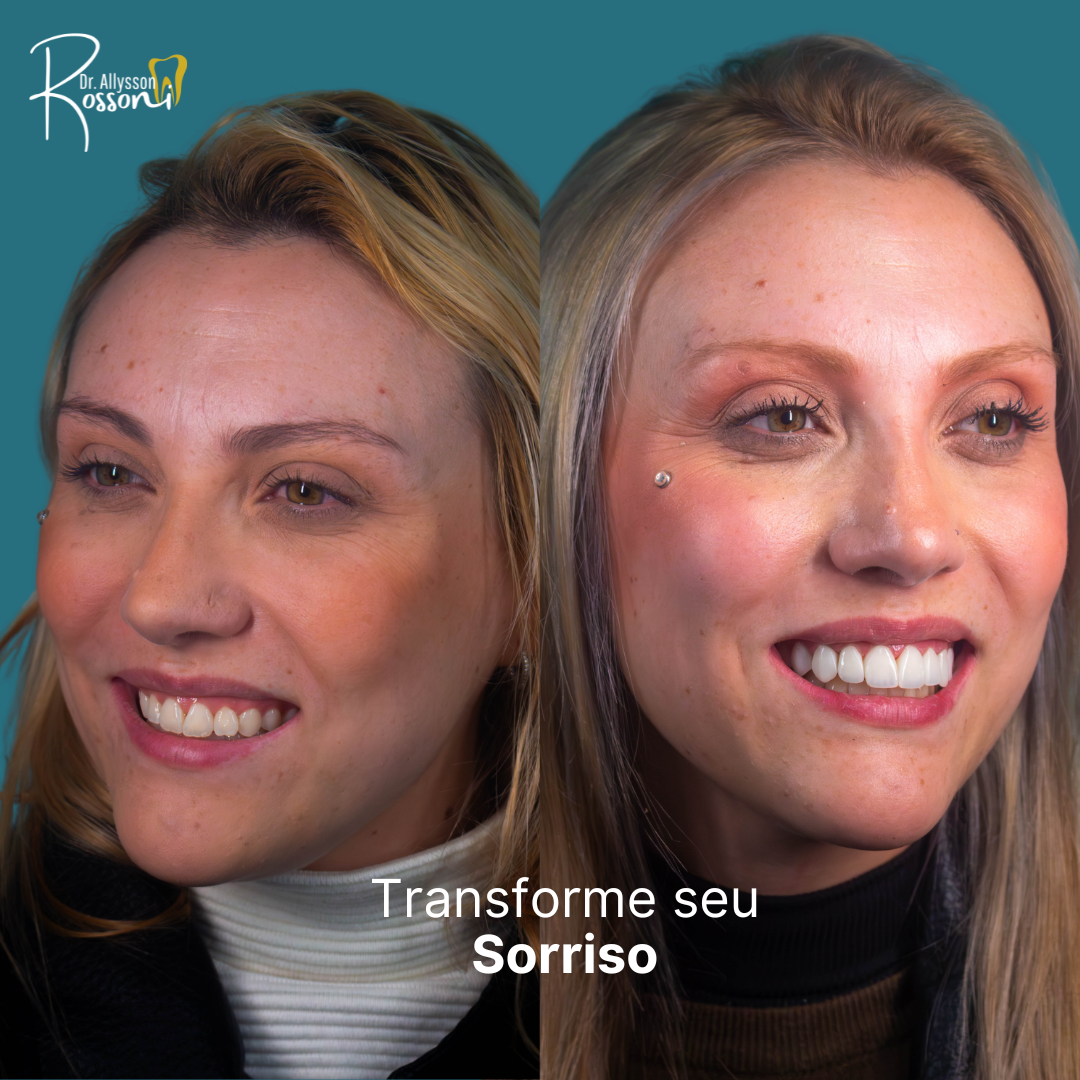 Transforme seu Sorisso